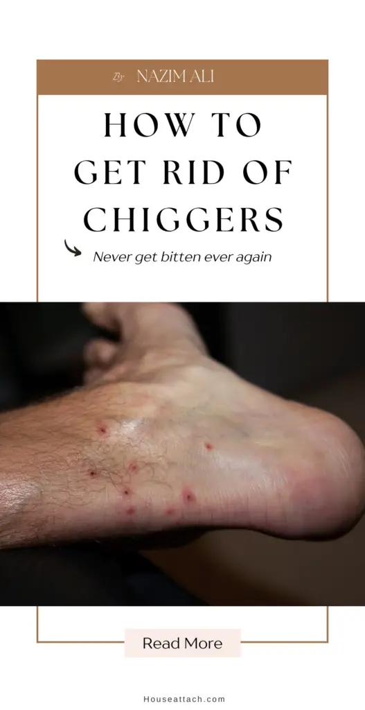 How to get rid of chiggers